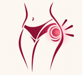 Soothe hip and buttock pain for pain-free nights.